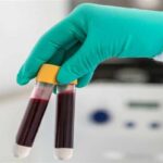 В США одобрили тест на коронавирус за 5 долларов В США одобрили тест на коронавирус за 5 долларов