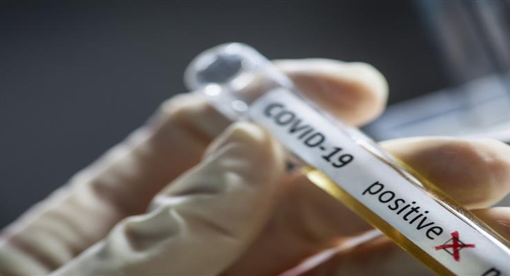 ЄС погодився закупити вакцину у Sanofi і GlaxoSmithKline