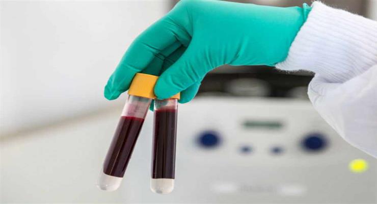 новий експрес-тест, щоб виявити COVID-19