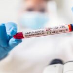 Прем'єр-міністр Хорватії заразився коронавірусом