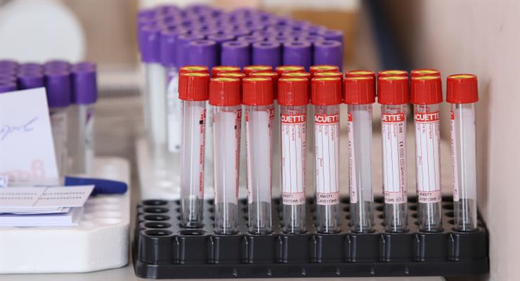 97% донорів крові в Нідерландах мають антитіла до коронавірусу